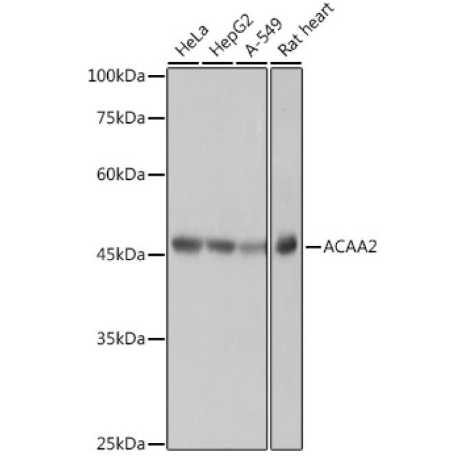 ACAA2 Rabbit Monoclonal Antibody