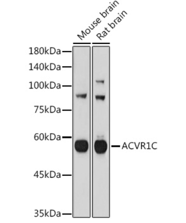 ACVR1C Rabbit Polyclonal Antibody