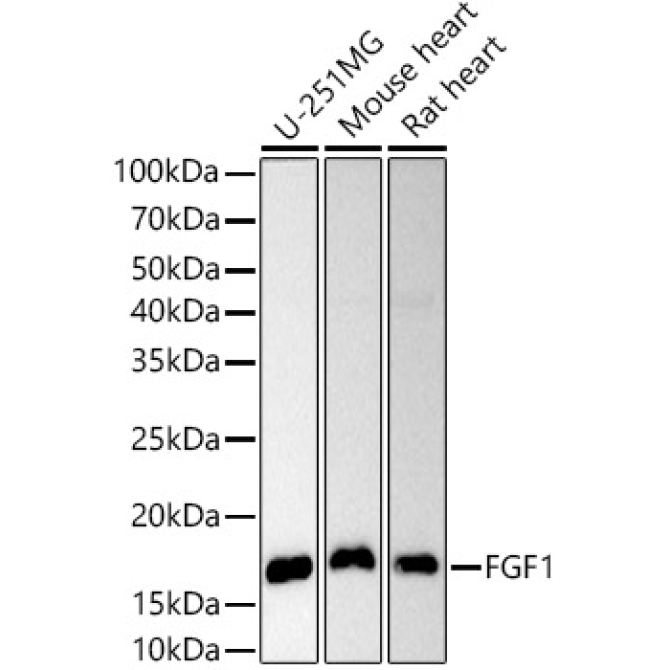 FGF1 Rabbit Polyclonal Antibody