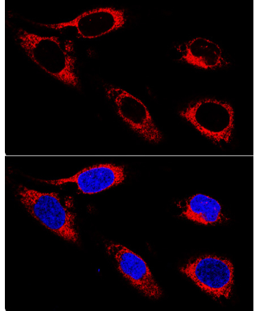 P4HB Rabbit Polyclonal Antibody
