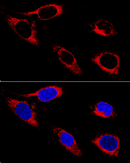 P4HB Rabbit Polyclonal Antibody