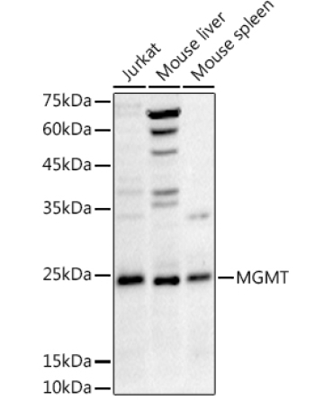 MGMT Rabbit Polyclonal Antibody