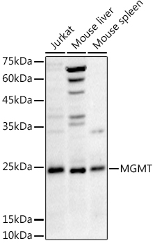 MGMT Rabbit Polyclonal Antibody