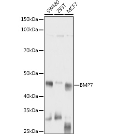 BMP7 Rabbit Polyclonal Antibody