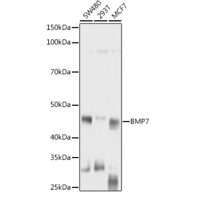 BMP7 Rabbit Polyclonal Antibody