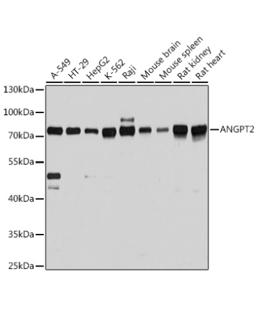 ANGPT2 Rabbit Polyclonal Antibody