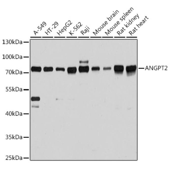 ANGPT2 Rabbit Polyclonal Antibody
