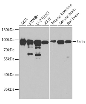 Ezrin Rabbit Polyclonal Antibody