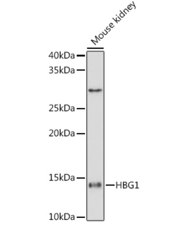 HBG1/2 Rabbit Monoclonal Antibody