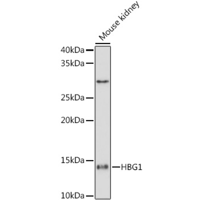 HBG1/2 Rabbit Monoclonal Antibody