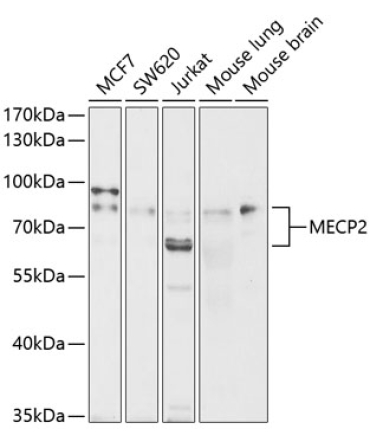 MECP2 Rabbit Polyclonal Antibody [KO Validated]