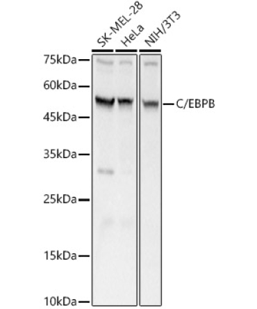 C/EBPB Rabbit Polyclonal Antibody