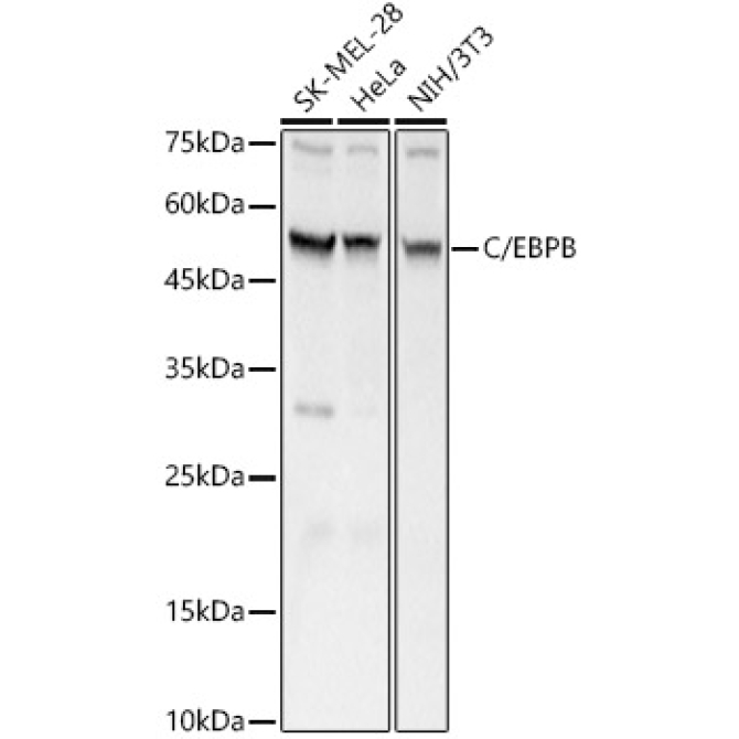 C/EBPB Rabbit Polyclonal Antibody