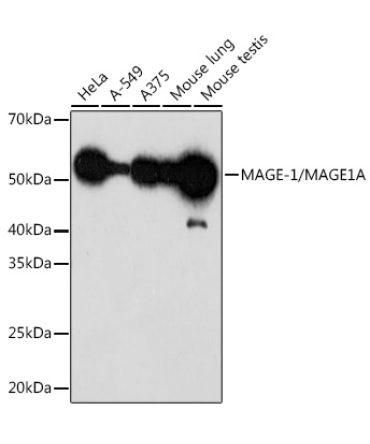MAGE-1/MAGE1A Rabbit Monoclonal Antibody