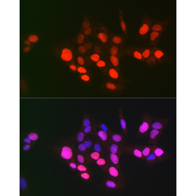 DNA topoisomerase II alpha (TOP2A) Rabbit Polyclonal Antibody