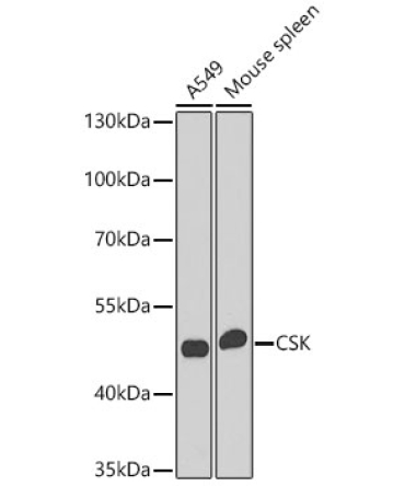 CSK Rabbit Polyclonal Antibody
