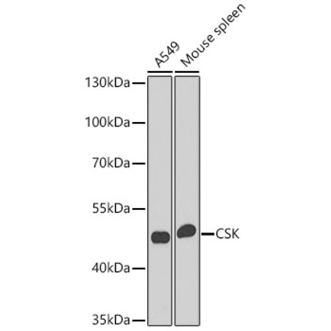 CSK Rabbit Polyclonal Antibody