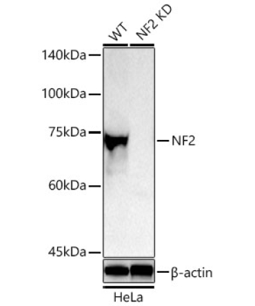 NF2 Rabbit Polyclonal Antibody [KD Validated]