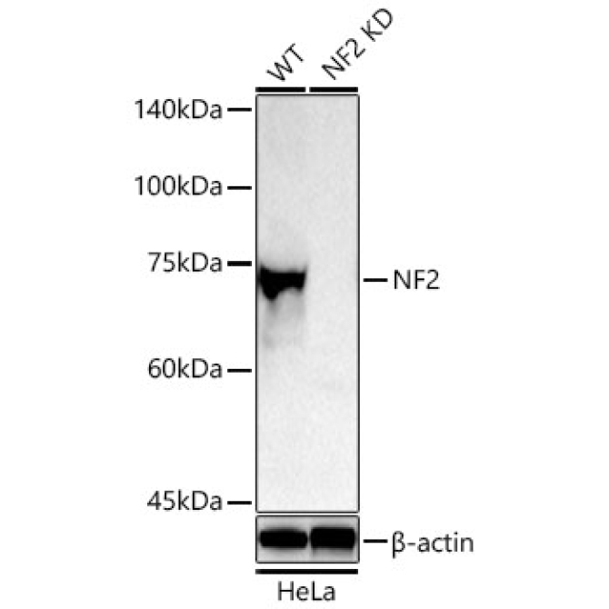 NF2 Rabbit Polyclonal Antibody [KD Validated]