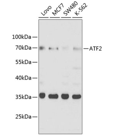 ATF2 Rabbit Polyclonal Antibody