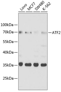 ATF2 Rabbit Polyclonal Antibody