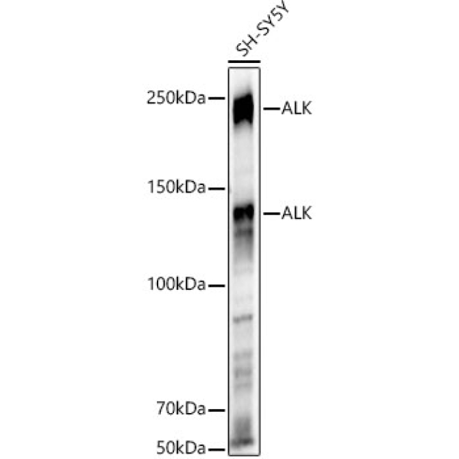 ALK Rabbit Polyclonal Antibody