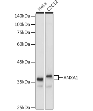 ANXA1 Rabbit Polyclonal Antibody