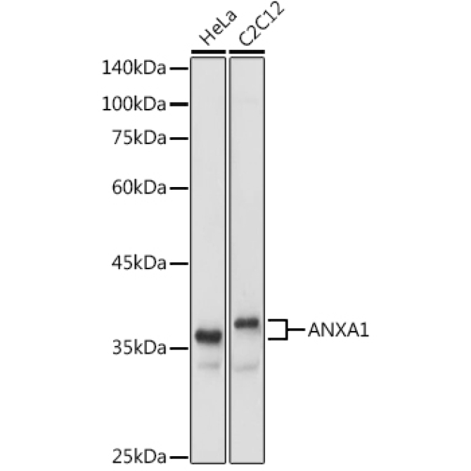 ANXA1 Rabbit Polyclonal Antibody