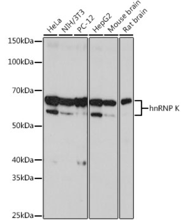 hnRNP K Rabbit Monoclonal Antibody