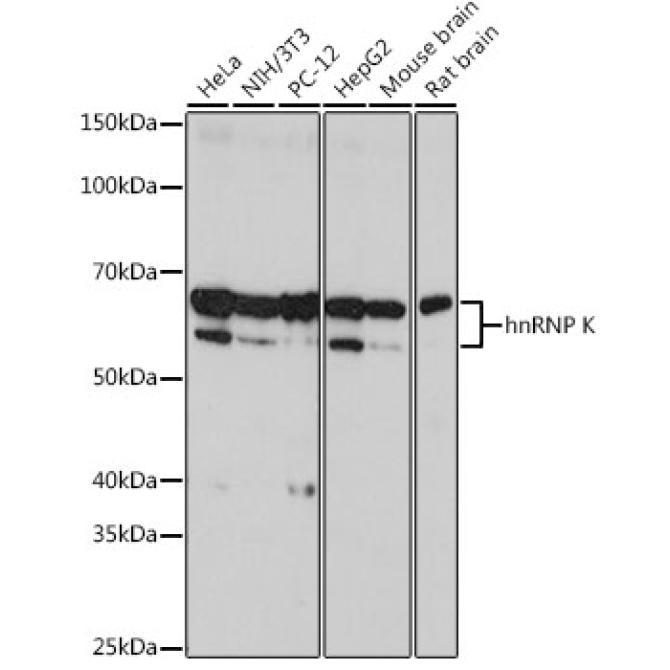 hnRNP K Rabbit Monoclonal Antibody