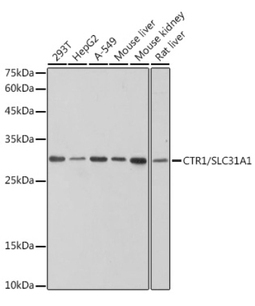 CTR1/SLC31A1 Rabbit Monoclonal Antibody