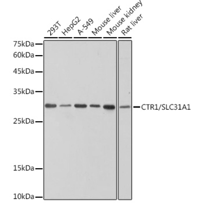 CTR1/SLC31A1 Rabbit Monoclonal Antibody