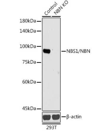 NBS1/NBN Rabbit Polyclonal Antibody [KO Validated]
