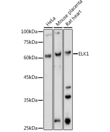 ELK1 Rabbit Polyclonal Antibody