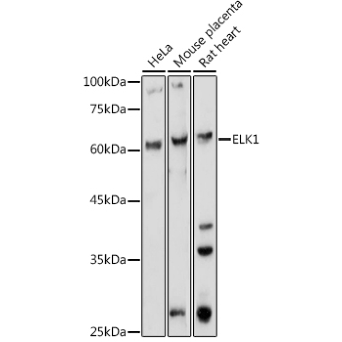 ELK1 Rabbit Polyclonal Antibody