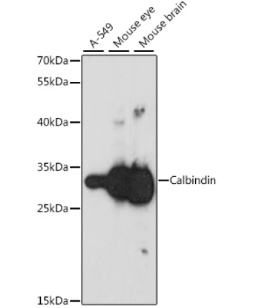 Calbindin Rabbit Polyclonal Antibody