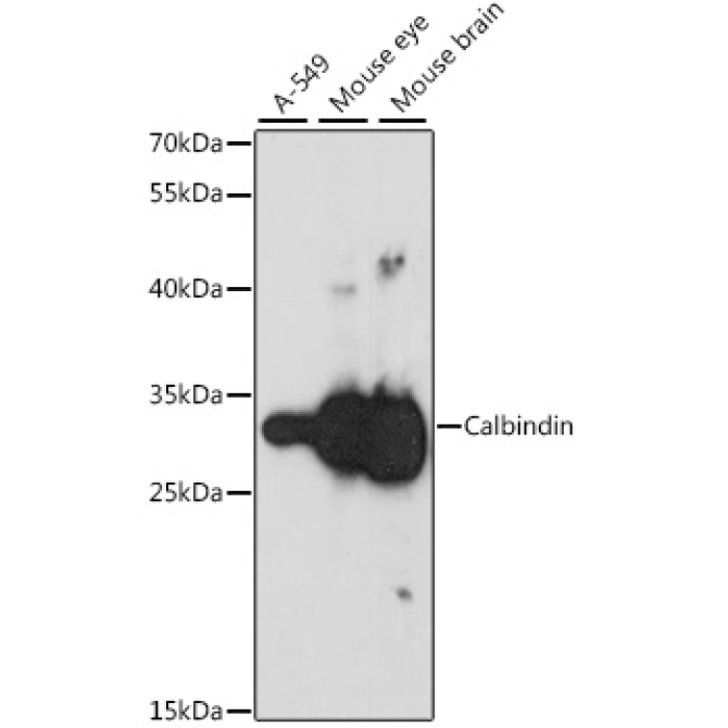 Calbindin Rabbit Polyclonal Antibody