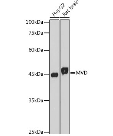 MVD Rabbit Monoclonal Antibody