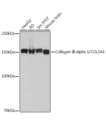 Collagen III alpha 1/COL3A1 Rabbit Monoclonal Antibody