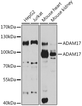 ADAM17 Rabbit Polyclonal Antibody