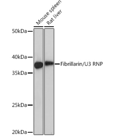 Fibrillarin/U3 RNP Rabbit Monoclonal Antibody