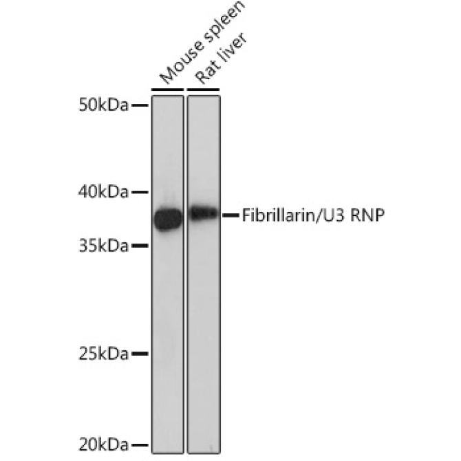Fibrillarin/U3 RNP Rabbit Monoclonal Antibody