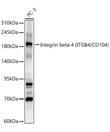 Integrin beta 4 (ITGB4/CD104) Rabbit Polyclonal Antibody