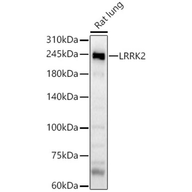LRRK2 Rabbit Polyclonal Antibody