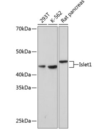Islet1 Rabbit Monoclonal Antibody