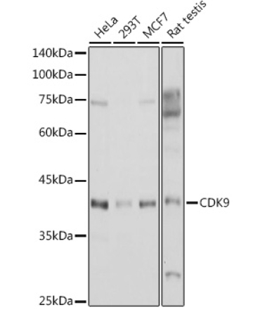CDK9 Rabbit Polyclonal Antibody