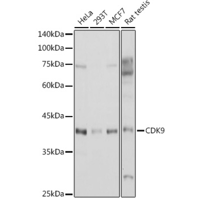CDK9 Rabbit Polyclonal Antibody