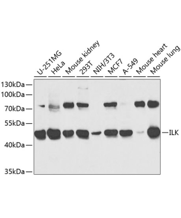 ILK Rabbit Polyclonal Antibody