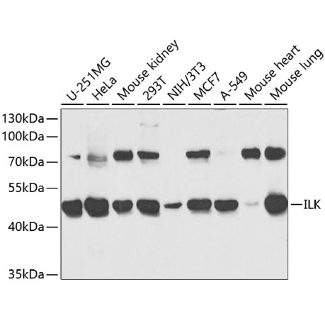 ILK Rabbit Polyclonal Antibody