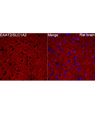 EAAT2/SLC1A2 Rabbit Polyclonal Antibody